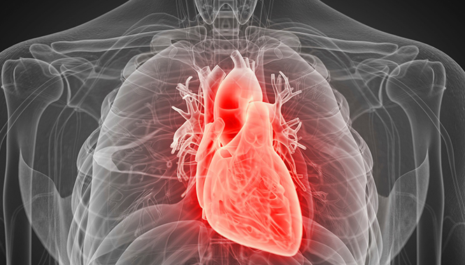 Cardiac Disease Congestive Heart Failure CHF and Cardiomyopathy Post MI Myocardial Infarction