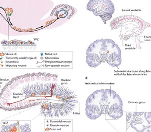 Featured Beverly Hills Stem Cell Treatment Center Stem Cells for Neurodegenerative Conditions