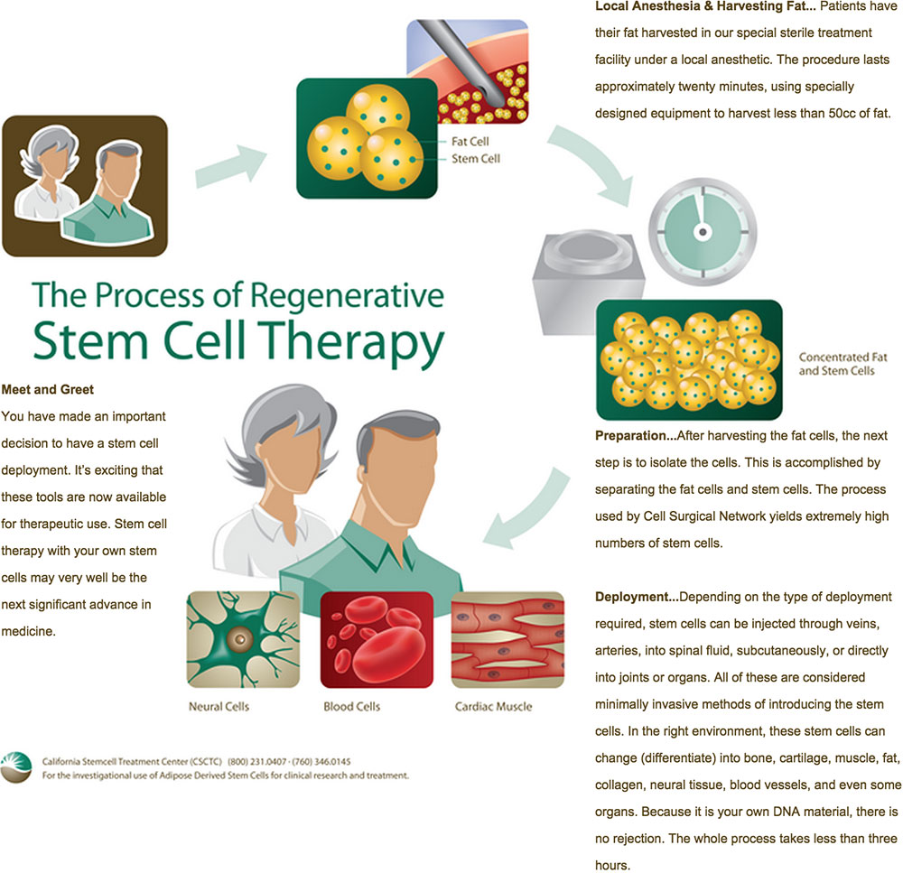 Southern California stem cell treatment center process
